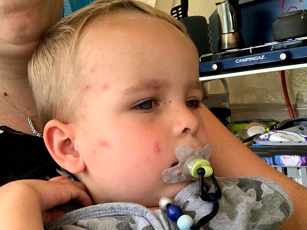 Krankes Kind auf dem Campingplatz